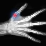 Como Sanar Una Confianza Que Ha Sido Fracturada