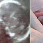 El Medico Vio Una Nariz Enorme En El Ultrasonido Cuando El Bebe Nacio Su Madre Se Espanto