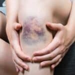10 Sintomas Del Cancer Que La Mayoria De Las Personas Ignoran