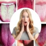 7 Problemas De Salud Que Puedes Detectar Con Solo Mirar Tu Lengua